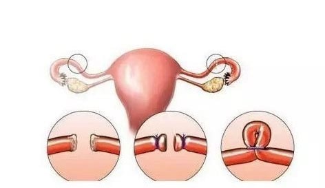 夏天月经来肚子疼怎么办