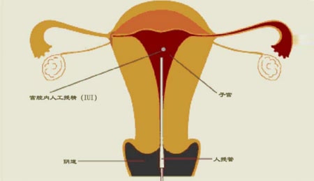 上海喜临门代孕